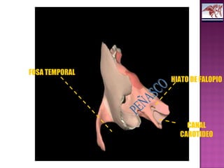 FOSA TEMPORAL
CANAL
CAROTIDEO
HIATO DE FALOPIO
 