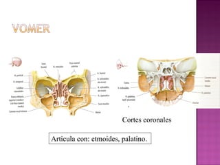 Cortes coronales
Articula con: etmoides, palatino.
 