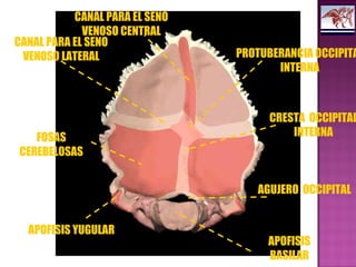 PROTUBERANCIA OCCIPITA
INTERNA
CRESTA OCCIPITAL
INTERNA
AGUJERO OCCIPITAL
APOFISIS YUGULAR
FOSAS
CEREBELOSAS
CANAL PARA EL SENO
VENOSO LATERAL
CANAL PARA EL SENO
VENOSO CENTRAL
APOFISIS
BASILAR
 