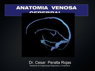 ANATOMIA VENOSAANATOMIA VENOSA
CEREBRALCEREBRAL
Dr. Cesar Peralta RojasDr. Cesar Peralta Rojas
Residente de Imagenología Diagnóstica y Terapéutica.Residente de Imagenología Diagnóstica y Terapéutica.
 