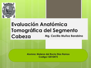 Evaluación Anatómica 
Tomográfica del Segmento 
Cabeza Mg. Cecilia Muñoz Barabino 
Alumna: Malena del Rocio Diaz Ramos 
Codigo:12010473 
 