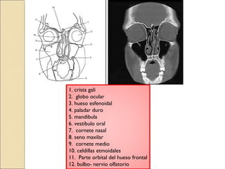 1. crista gali 
2. globo ocular 
3. hueso esfenoidal 
4. paladar duro 
5. mandibula 
6. vestibulo oral 
7. cornete nasal 
8. seno maxilar 
9. cornete medio 
10. celdillas etmoidales 
11. Parte orbital del hueso frontal 
12. bulbo- nervio olfatorio 
 