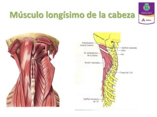 Músculo longísimo de la cabeza
 