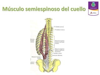 Músculo semiespinoso del cuello
 
