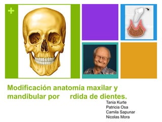 +
Modificación anatomía maxilar y
mandibular por rdida de dientes.
Tania Kurte
Patricia Osa
Camila Sapunar
Nicolas Mora
 