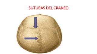 SUTURAS DEL CRANEO
 