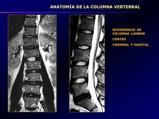 Vertebra Coronal ANATOMIA_DE_LA_COLUMNA_VERTEBRAL.pdf