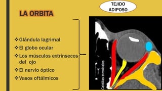 LA ORBITA
Glándula lagrimal
El globo ocular
Los músculos extrínsecos
del ojo
El nervio óptico
Vasos oftálmicos
TEJIDO
ADIPOSO
 
