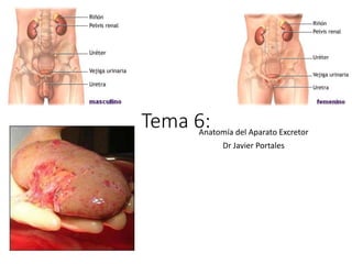 Tema 6:Anatomía del Aparato Excretor
Dr Javier Portales
 