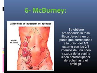 Se obtiene
presionando la fosa
ilíaca derecha en un
punto que corresponde
a la unión del 1/3
externo con los 2/3
internos de una línea
trazada de la espina
ilíaca anterosuperior
derecha hasta el
ombligo 
 
