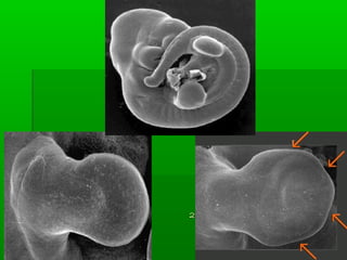 2211--2266 ddííaass 
 