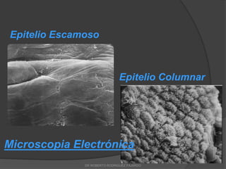 Epitelio Escamoso
Epitelio Columnar
Microscopia Electrónica
DR ROBERTO RODRIGUEZ FAJARDO
 