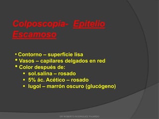 Colposcopia- Epitelio
Escamoso
• Contorno – superficie lisa
• Vasos – capilares delgados en red
• Color después de:
 sol.salina – rosado
 5% ác. Acético – rosado
 lugol – marrón oscuro (glucógeno)
DR ROBERTO RODRIGUEZ FAJARDO
 
