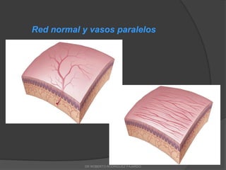 Red normal y vasos paralelos
DR ROBERTO RODRIGUEZ FAJARDO
 