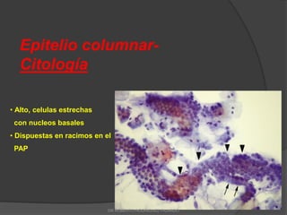 Epitelio columnar-
Citología
• Alto, celulas estrechas
con nucleos basales
• Dispuestas en racimos en el
PAP
DR ROBERTO RODRIGUEZ FAJARDO
 