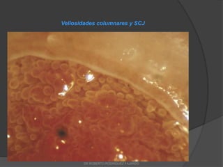 Vellosidades columnares y SCJ
DR ROBERTO RODRIGUEZ FAJARDO
 