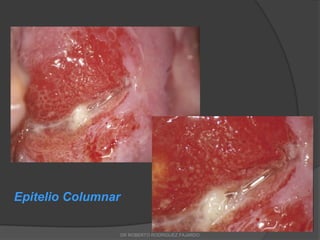 Epitelio Columnar
DR ROBERTO RODRIGUEZ FAJARDO
 