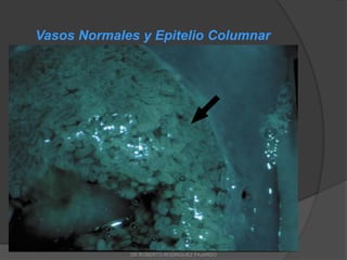 Vasos Normales y Epitelio Columnar
DR ROBERTO RODRIGUEZ FAJARDO
 