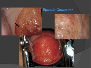 Epitelio Columnar
DR ROBERTO RODRIGUEZ FAJARDO
 