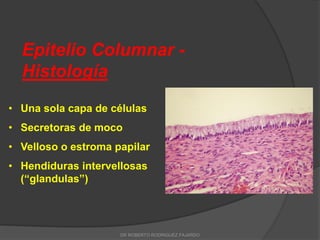 Epitelio Columnar -
Histología
• Una sola capa de células
• Secretoras de moco
• Velloso o estroma papilar
• Hendiduras intervellosas
(“glandulas”)
DR ROBERTO RODRIGUEZ FAJARDO
 