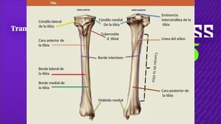 Tibia Linea Comprehensive Anatomy of the Lower Limb Muscles and Bones for Medical ...