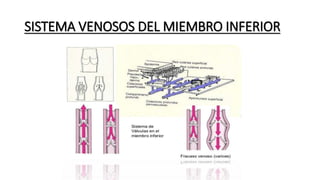 SISTEMA VENOSOS DEL MIEMBRO INFERIOR
 