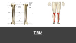 TIBIA
 