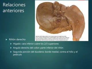 Relaciones
anteriores
 Riñón derecho
 Hígado: cara inferior cubre los 2/3 superiores
 Angulo derecho del colon: parte inferior del riñón
 Segunda porción del duodeno: borde medial, contra el hilio y el
pedículo
 