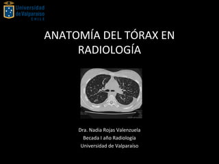 ANATOMÍA DEL TÓRAX EN
RADIOLOGÍA
Dra. Nadia Rojas Valenzuela
Becada I año Radiología
Universidad de Valparaíso
 