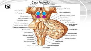 ANATOMIA DEL TRONCO ENCEF. (1) [Autoguardado].pptx