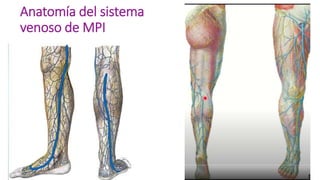 Anatomía del sistema
venoso de MPI
 