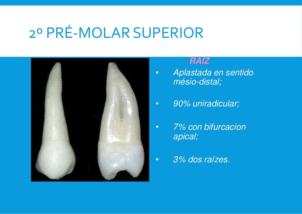 Anatomia Pré Molar Superior EDUBRAINAZ Anatomia Pré Molar Superior EDUBRAINAZ