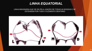 LINHA EQUATORIAL
LINHA IMAGINÁRIA QUE SE DÁ PELA JUNÇÃO DE TODAS AS BOSSAS E SE
ESTENDEM POR TODO O ELEMENTO DENTÁRIO
10
 