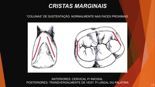 ANTERIORES: CERVICAL P/ INICISAL
POSTERIORES: TRANSVERSALMENTE DE VEST. P/ LINGAL OU PALATINA
CRISTAS MARGINAIS
“COLUNAS” DE SUSTENTAÇÃO. NORMALMENTE NAS FACES PROXIMAIS
12
 