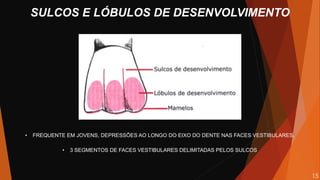 • FREQUENTE EM JOVENS, DEPRESSÕES AO LONGO DO EIXO DO DENTE NAS FACES VESTIBULARES.
• 3 SEGMENTOS DE FACES VESTIBULARES DELIMITADAS PELOS SULCOS
SULCOS E LÓBULOS DE DESENVOLVIMENTO
15
 