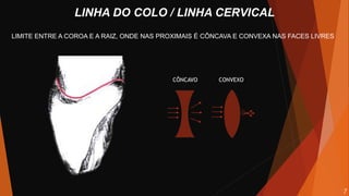 LINHA DO COLO / LINHA CERVICAL
LIMITE ENTRE A COROA E A RAIZ, ONDE NAS PROXIMAIS É CÔNCAVA E CONVEXA NAS FACES LIVRES
CÔNCAVO CONVEXO
7
 