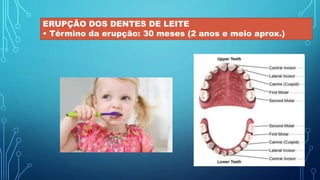 ERUPÇÃO DOS DENTES DE LEITE
• Término da erupção: 30 meses (2 anos e meio aprox.)
 