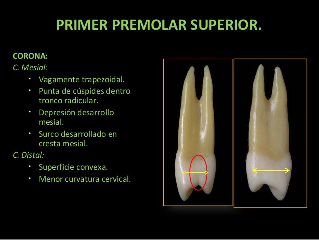 premolares superiores