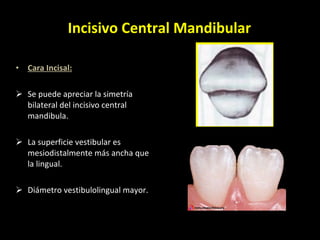 Cara Incisal: Se puede apreciar la simetría bilateral del incisivo central mandibula. La superficie vestibular es mesiodistalmente más ancha que la lingual. Diámetro vestibulolingual mayor. Incisivo Central Mandibular 