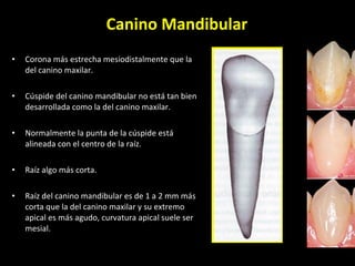 Canino Mandibular Corona más estrecha mesiodistalmente que la del canino maxilar. Cúspide del canino mandibular no está tan bien desarrollada como la del canino maxilar.  Normalmente la punta de la cúspide está alineada con el centro de la raíz. Raíz algo más corta. Raíz del canino mandibular es de 1 a 2 mm más corta que la del canino maxilar y su extremo apical es más agudo, curvatura apical suele ser mesial. 
