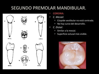 SEGUNDO PREMOLAR MANDIBULAR. CORONA: C. Mesial : C úspide vestibular no está centrada. No hay surco del desarrollo. C. Distal: Similar a la mesial. Superficie oclusal m ás visible. 