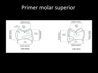 Primer molar superior  