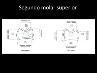 Segundo molar superior  