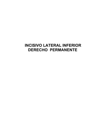 INCISIVO LATERAL INFERIOR
  DERECHO PERMANENTE
 
