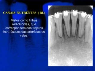 CANAIS NUTRENTES ( RL)
Vistos como linhas
radiolúcidas, que
correspondem aos trajetos
intra-ósseos das arteríolas ou
veias.
 