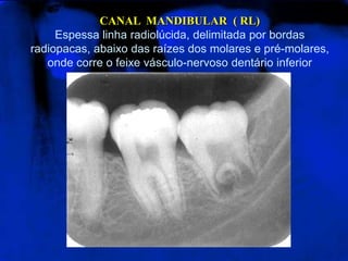 CANAL MANDIBULAR ( RL)
Espessa linha radiolúcida, delimitada por bordas
radiopacas, abaixo das raízes dos molares e pré-molares,
onde corre o feixe vásculo-nervoso dentário inferior
 
