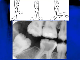 Anatomiadento maxilo-mandibular-110429050346-phpapp02