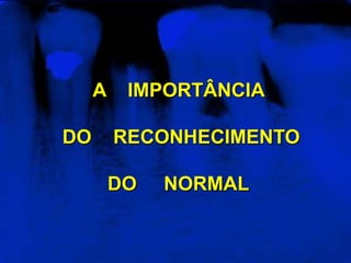 A    IMPORTÂNCIA DO    RECONHECIMENTODO     NORMAL