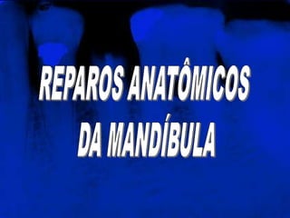 REPAROS ANATÔMICOS DA MANDÍBULA