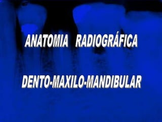 ANATOMIA   RADIOGRÁFICA DENTO-MAXILO-MANDIBULAR 